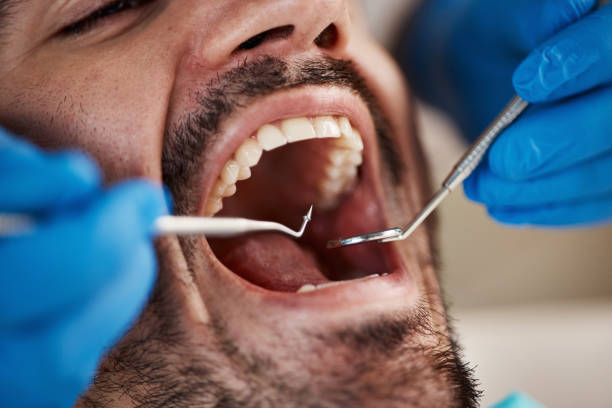 Best Wisdom Tooth Removal  in Pontoon Beach, IL